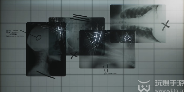 How to open the third floor turntable lock on Silent Hill 2 remake version of the hospital
