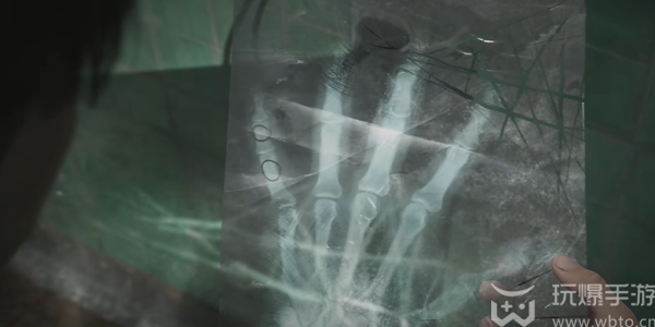 How to open the third floor turntable lock on the Silent Hill 2 remake hospital